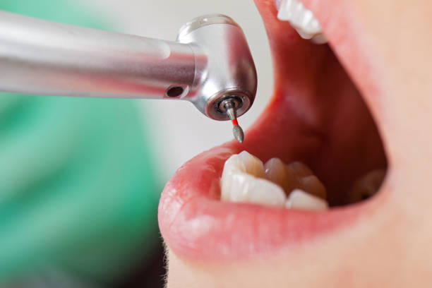 Best Emergency Dental Services for Seniors in Potosi, TX